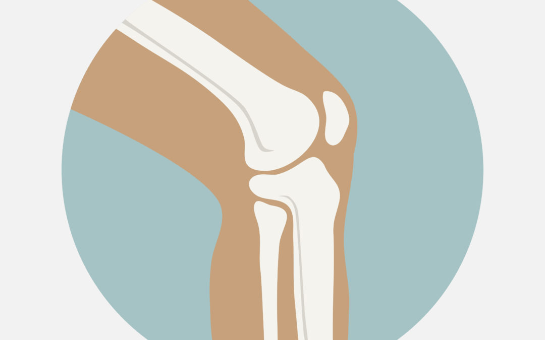 Osteoid osteoma: a propensity score matching study