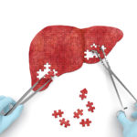 Measuring the length of the right hepatic duct