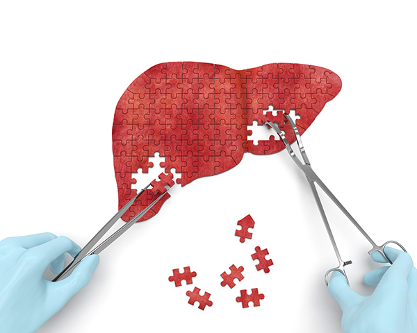 Measuring the length of the right hepatic duct