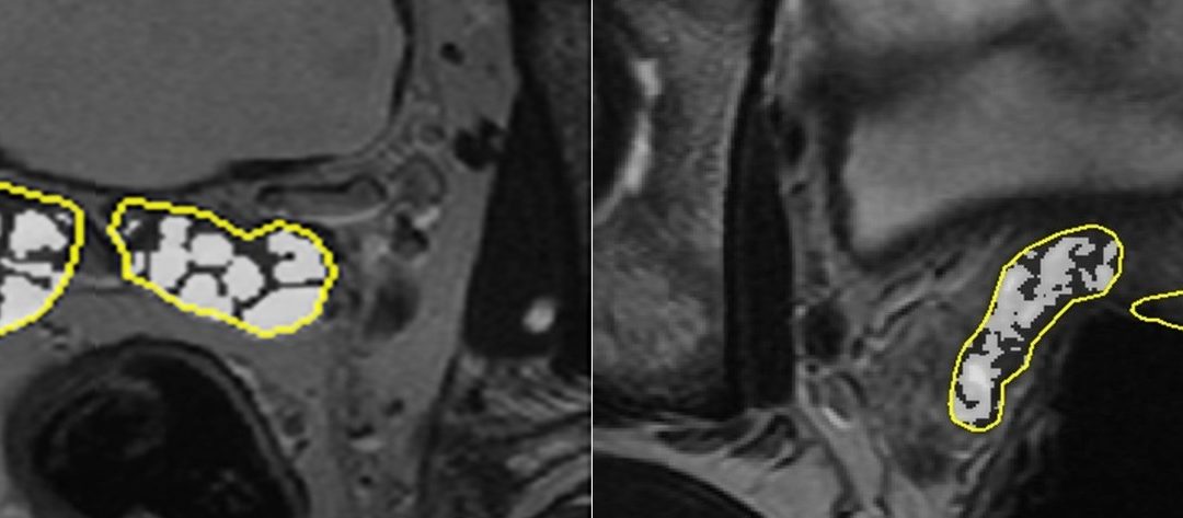 What happens to seminal vesicles after ejaculation?