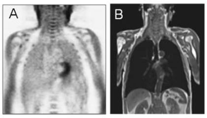 PET-MRI for cardiac imaging: statement from the ESCR and the EANM