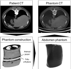 Building an anthropomorphic phantom with 3D printing for simulation in Intervention