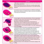 Guidelines from ESUR: endometrial cancer