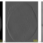 What is grating-interferometry mammography?